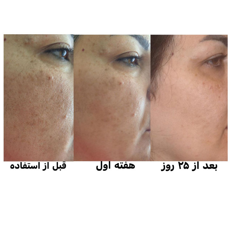 کرم ضد لک لاکچری کوئین
