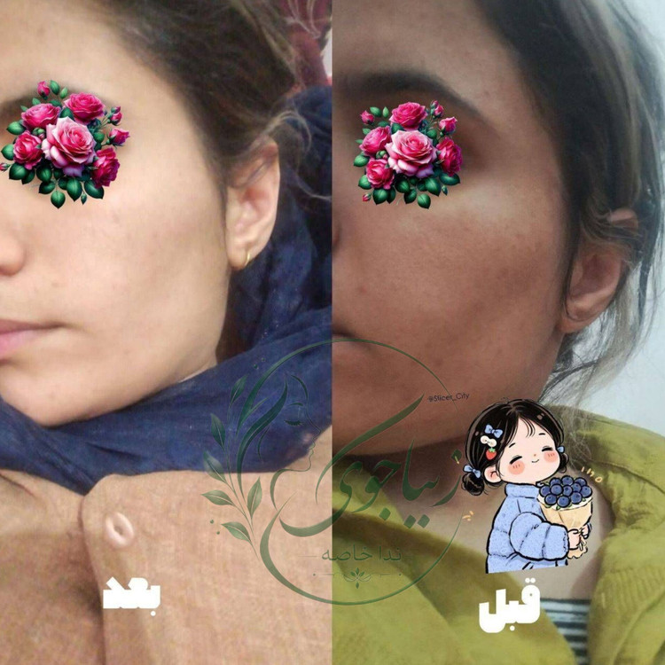 کرم ویتامین سی