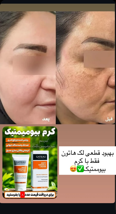 کرم ویتامین سی