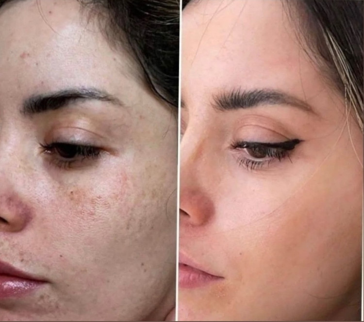 سرم مغذی لاکچری کوئین