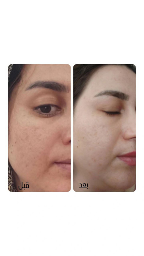 سرم مغذی لاکچری کوئین