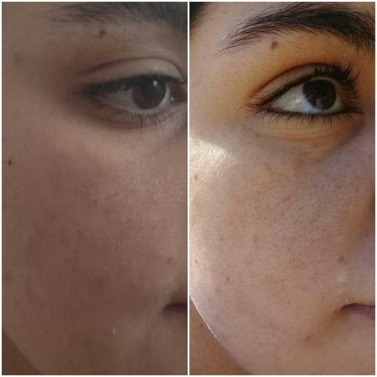 سرم مغذی لاکچری کوئین