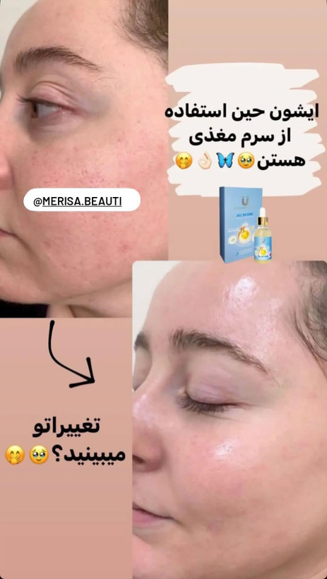 سرم مغذی لاکچری کوئین