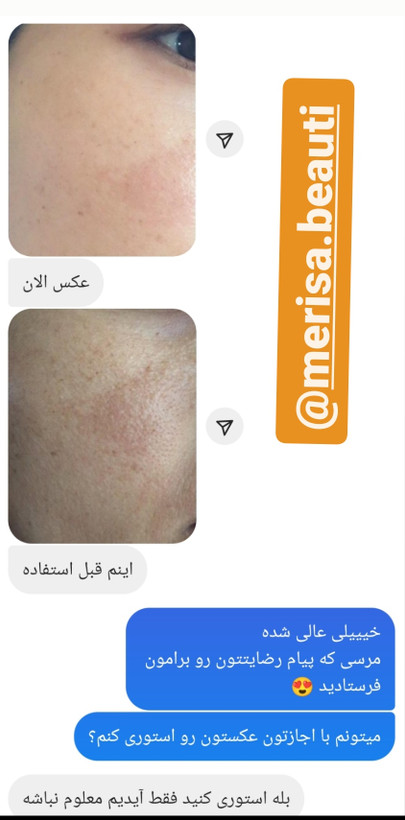 کرم روز لاکچری کوئین