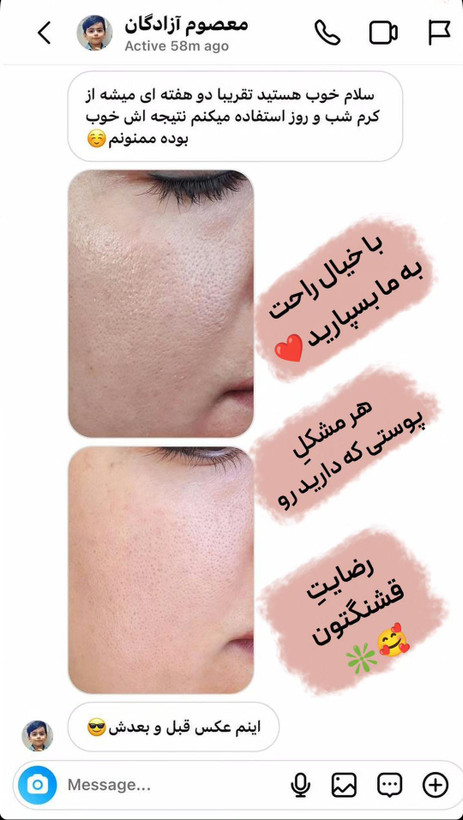 کرم روز لاکچری کوئین