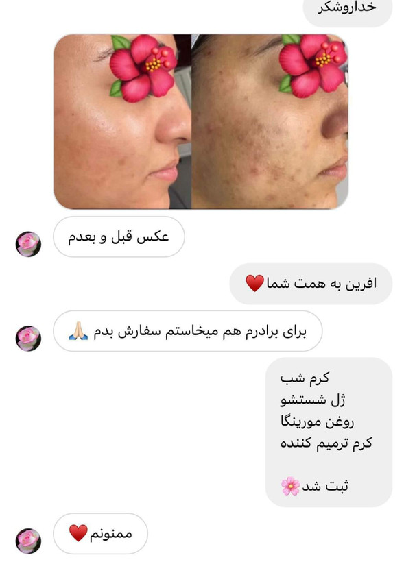 کرم شب لاکچری کوئین