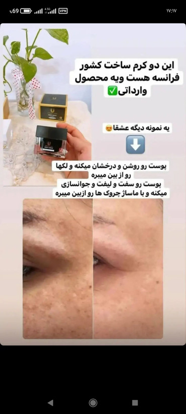 کرم شب لاکچری کوئین