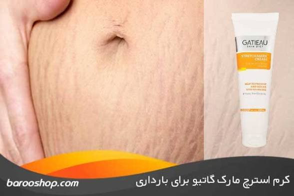 کرم ترکهای پوستی گاتیو (استرچ مارک)