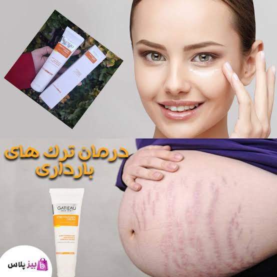 کرم ترکهای پوستی گاتیو (استرچ مارک)
