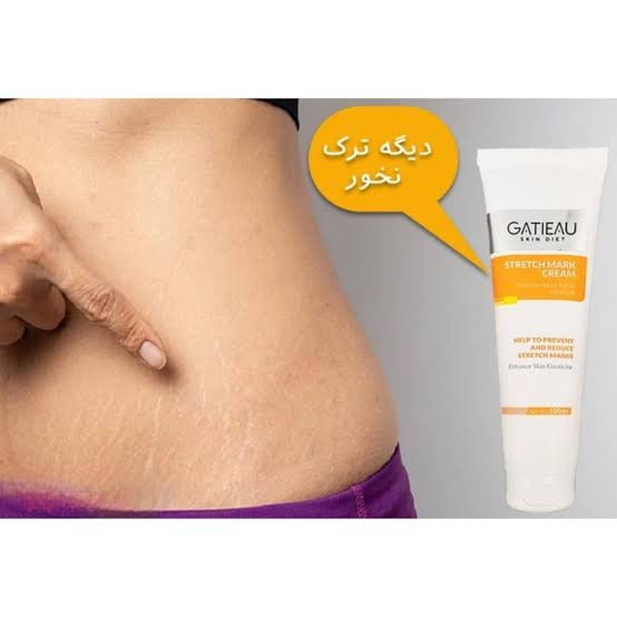 کرم ترکهای پوستی گاتیو (استرچ مارک)