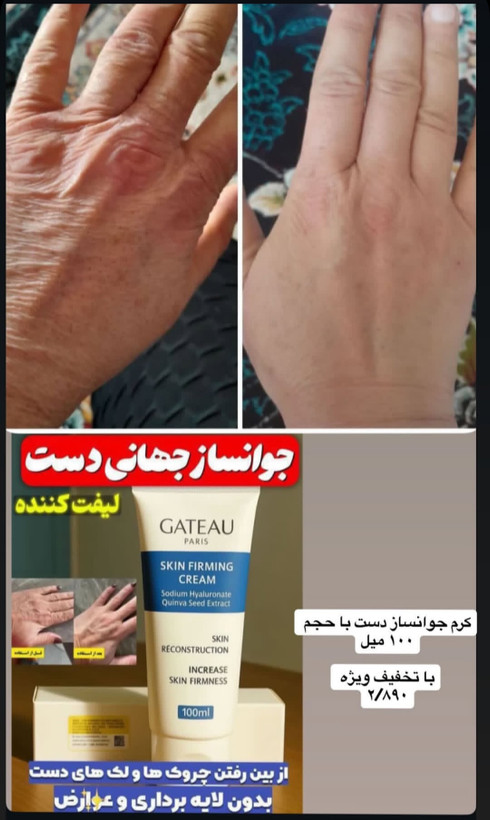 کرم سفت کننده و روشن کننده دست گاتیو