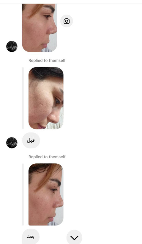 ژل شستشوی صورت ویتابلا