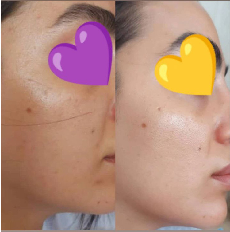 ژل شستشوی صورت ویتابلا