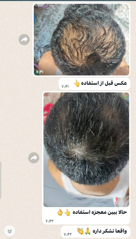 شامپوی ضد ریزش و رویش مجدد هیرفرند